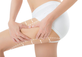 Tratamientos presoterapia en Vallecas